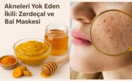 Akneleri Yok Eden İkili: Zerdeçal ve Bal Maskesi